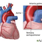 Diferencia entre la aorta y la arteria pulmonar
