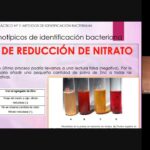 Diferencia entre la nitrato reductasa y la nitrito reductasa