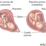 Diferencia entre la placenta y el útero