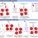 Diferencia entre la prueba de Coombs directa e indirecta