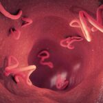 Diferencia entre la tiña y la lombriz intestinal