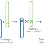 Diferencia entre la translocación recíproca y la robertsoniana