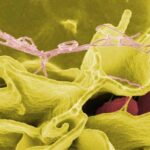 Diferencia entre Listeria y Salmonella