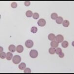 Diferencia entre Mycoplasma y PPLO