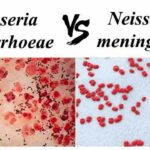 Diferencia entre Neisseria gonorrhoeae y Neisseria meningitidis