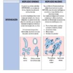 Diferencia entre neoplasia y neoplasia