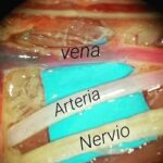 Diferencia entre nervio y vena