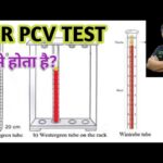 Diferencia entre PCV y ESR