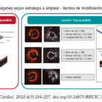 Diferencia entre placa y calcificación