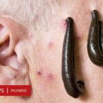 Diferencia entre sanguijuelas y chupasangres