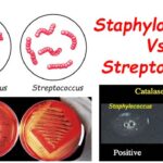 Diferencia entre Staphylococcus aureus y Streptococcus pyogenes