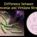 Diferencia entre Streptococcus pneumoniae y Streptococcus viridans
