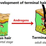 Diferencia entre vello y pelo terminal