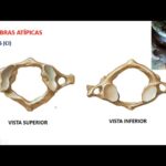 Diferencia entre vértebras típicas y atípicas