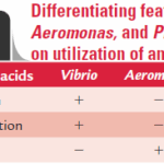 Diferencia entre Vibrio Aeromonas y Plesiomonas