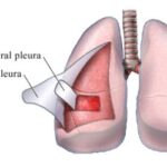Diferencia entre visceral y parietal