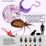 ¿Qué es la enfermedad de Chagas y qué la causa?