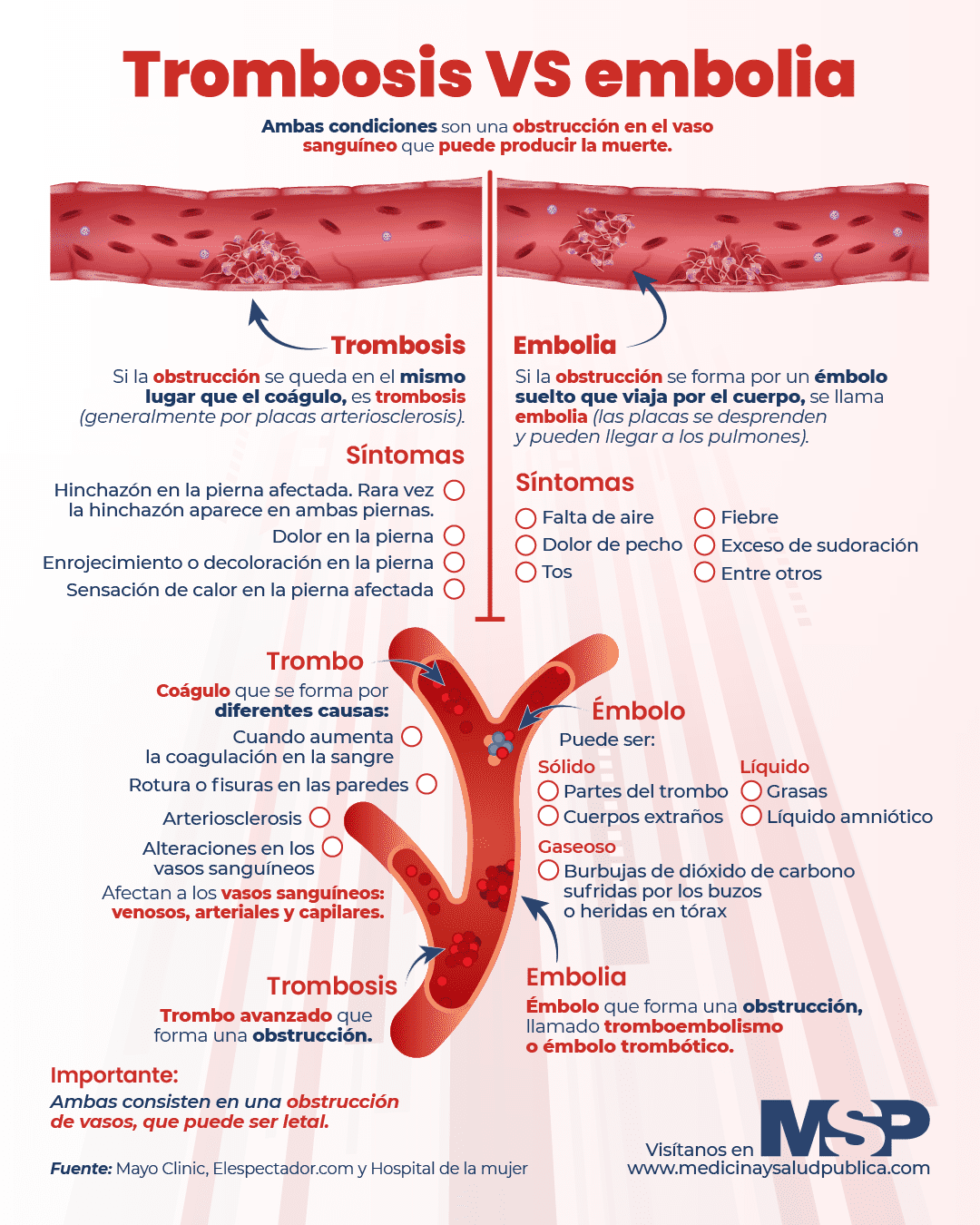 Diferencia entre trombo y émbolo